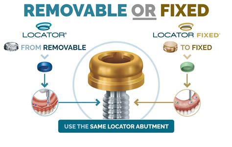 locator metal housing|locator attachment system.